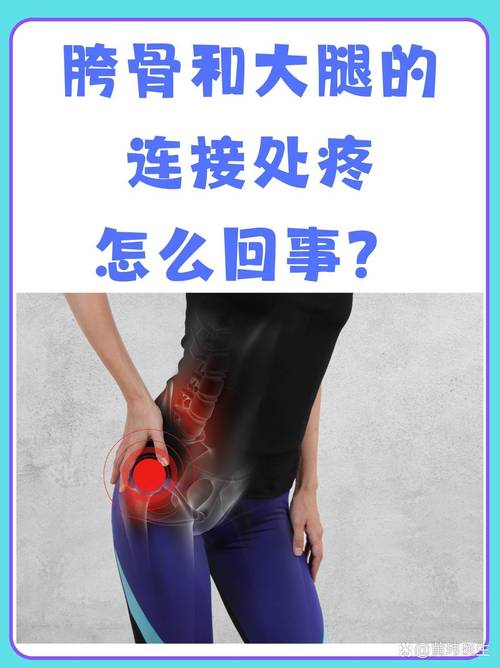 风湿胯骨疼是怎么回事