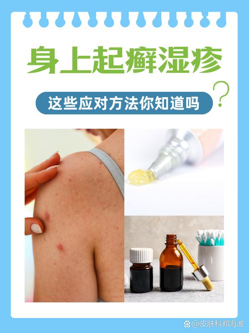 风湿疙瘩可以有盐擦吗