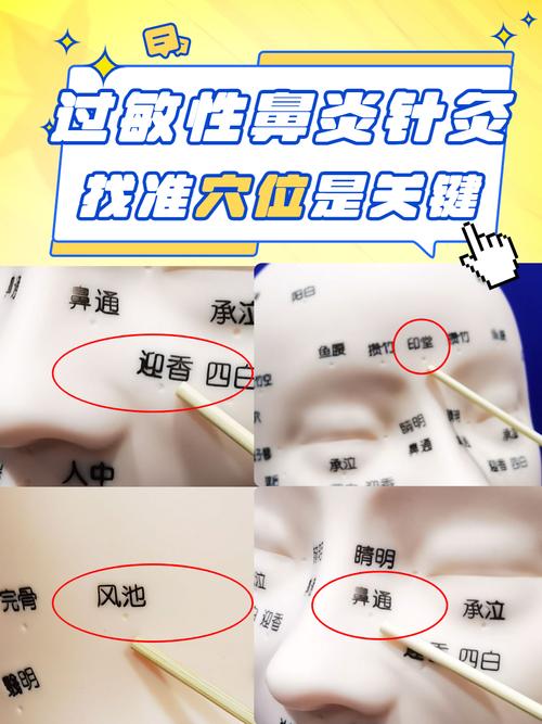 按摩委中穴位治鼻塞