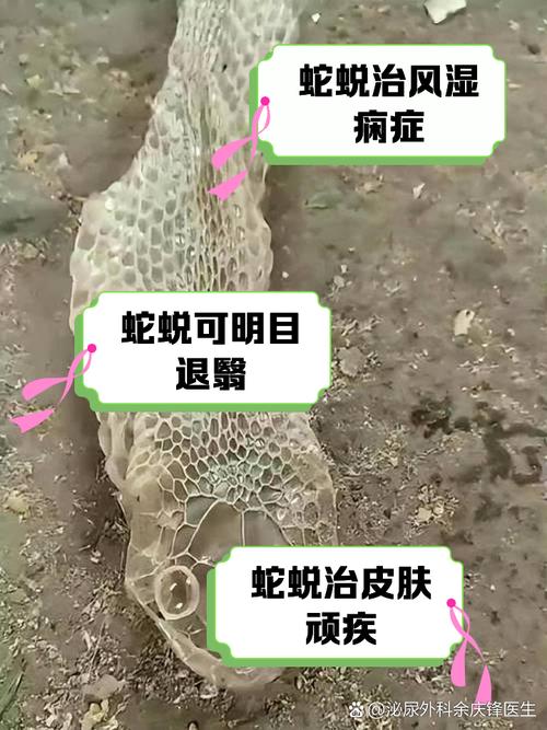 为什么泡蛇可以治风湿