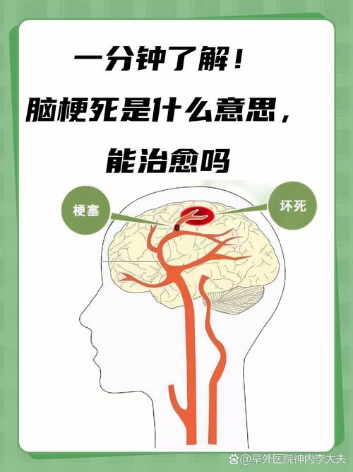 多发性脑梗是怎么回事