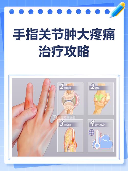 手类风湿怎样治疗方法