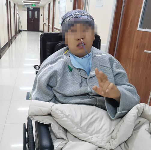 脑动脉瘤介入术后脑梗