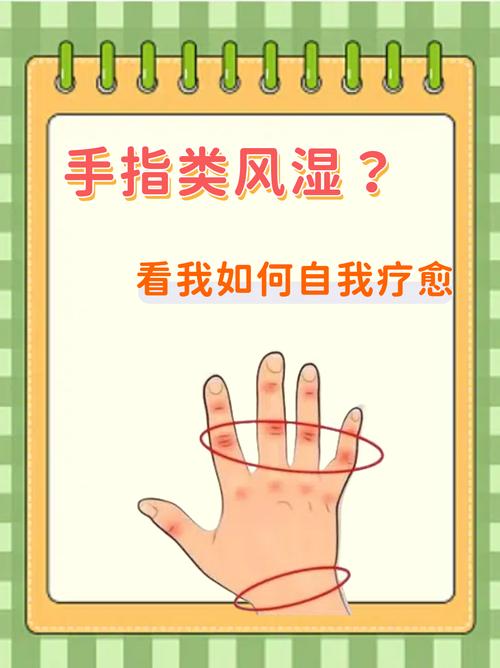 怎样判断类风湿活动期