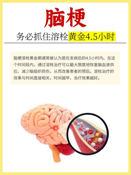 轻微的脑梗能买保险吗