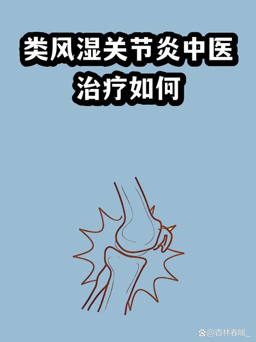 香港仙灵风湿散好用吗