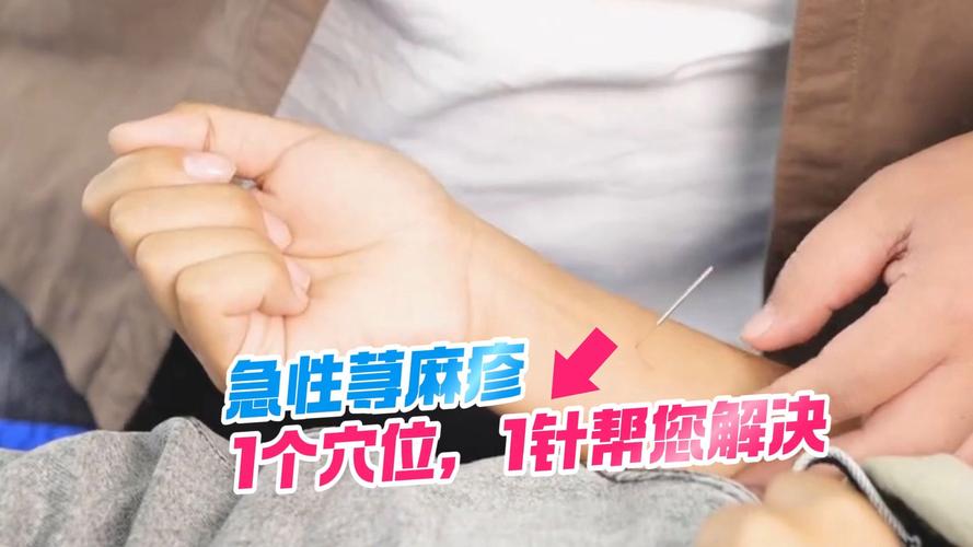 起疹子按摩什么穴位