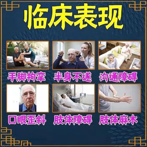 脑梗与脑血栓治疗方法