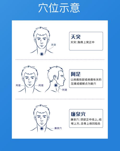 慢性咽炎有哪些穴位