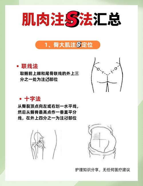 穴位注射与肌注异同