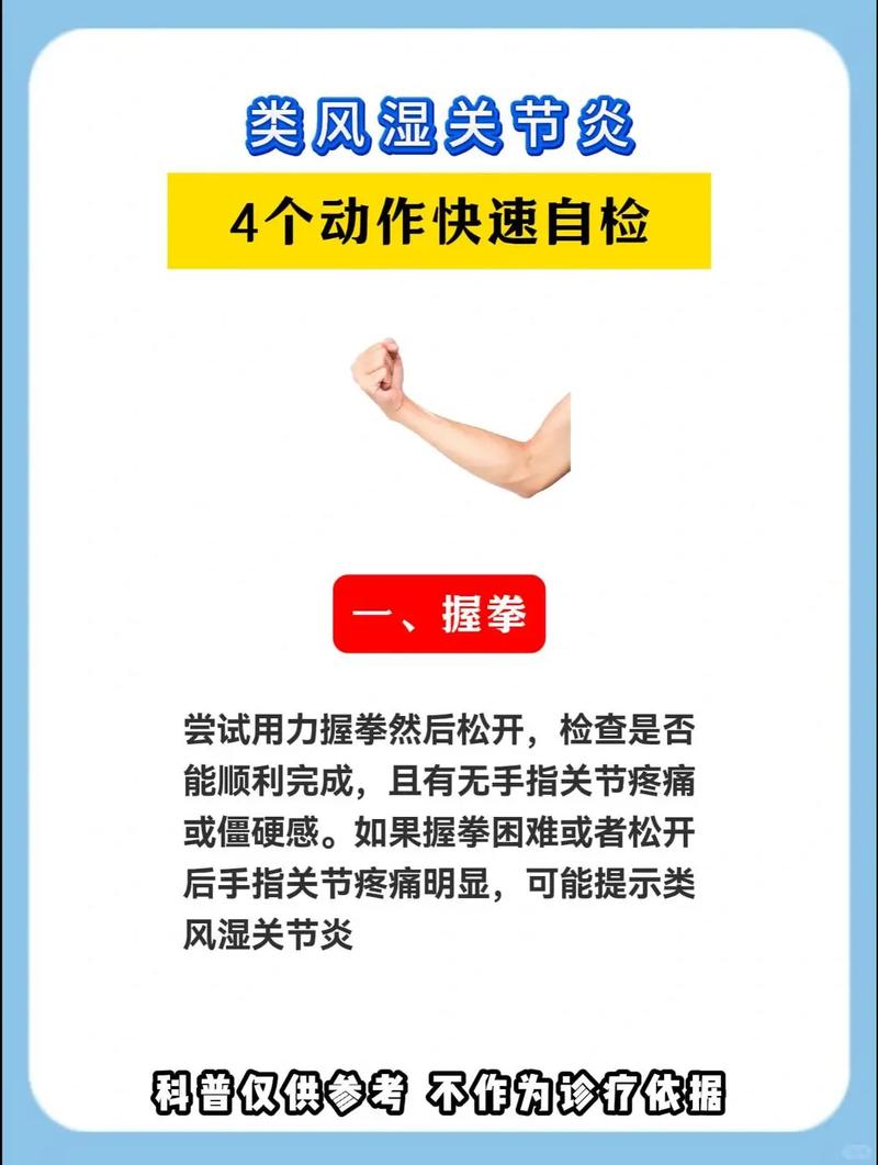 类风湿怎么治疗方法好