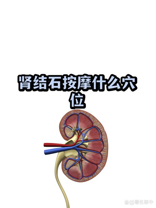 肾结石按压哪个穴位