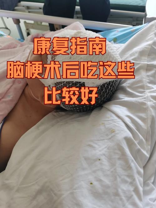 脑梗 多长时间 手术