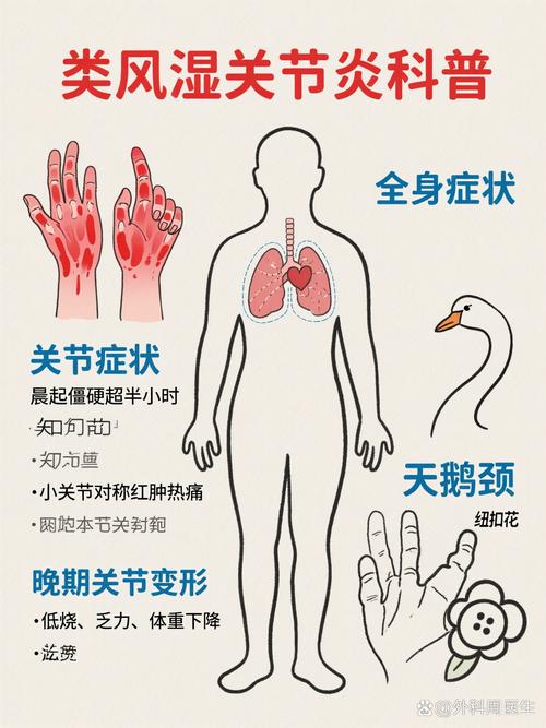 风湿性疾病常见的原因