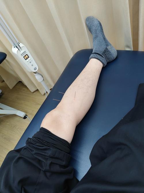 人体腿疼针灸穴位图
