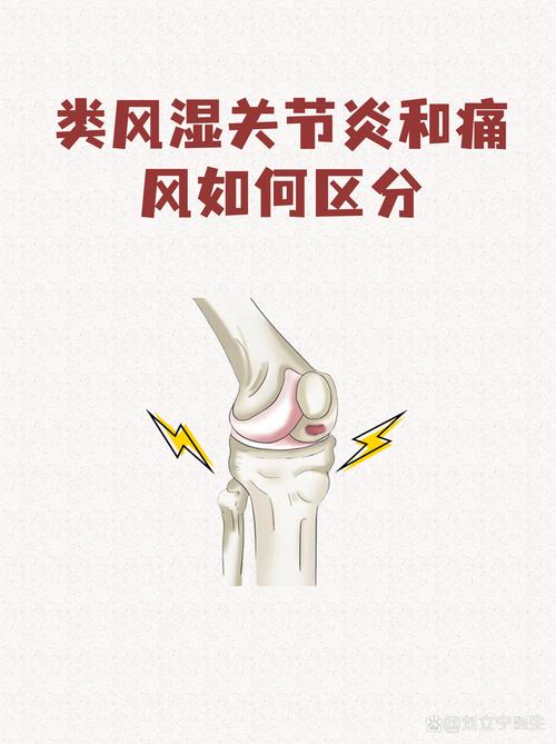 霸州市类风湿医院在哪