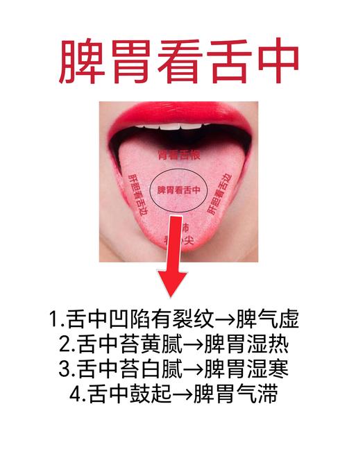 舌尖长溃疡神奇穴位