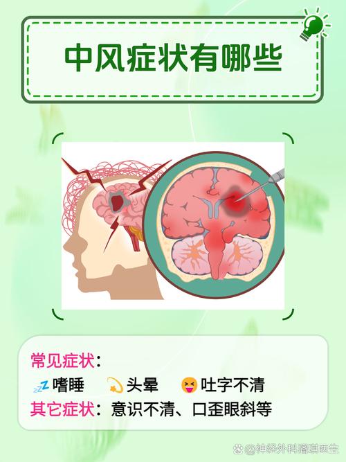 中风是不是脑梗的前兆