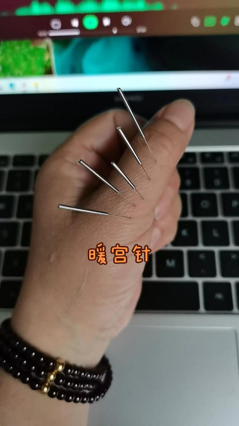 产后疼针灸哪个穴位