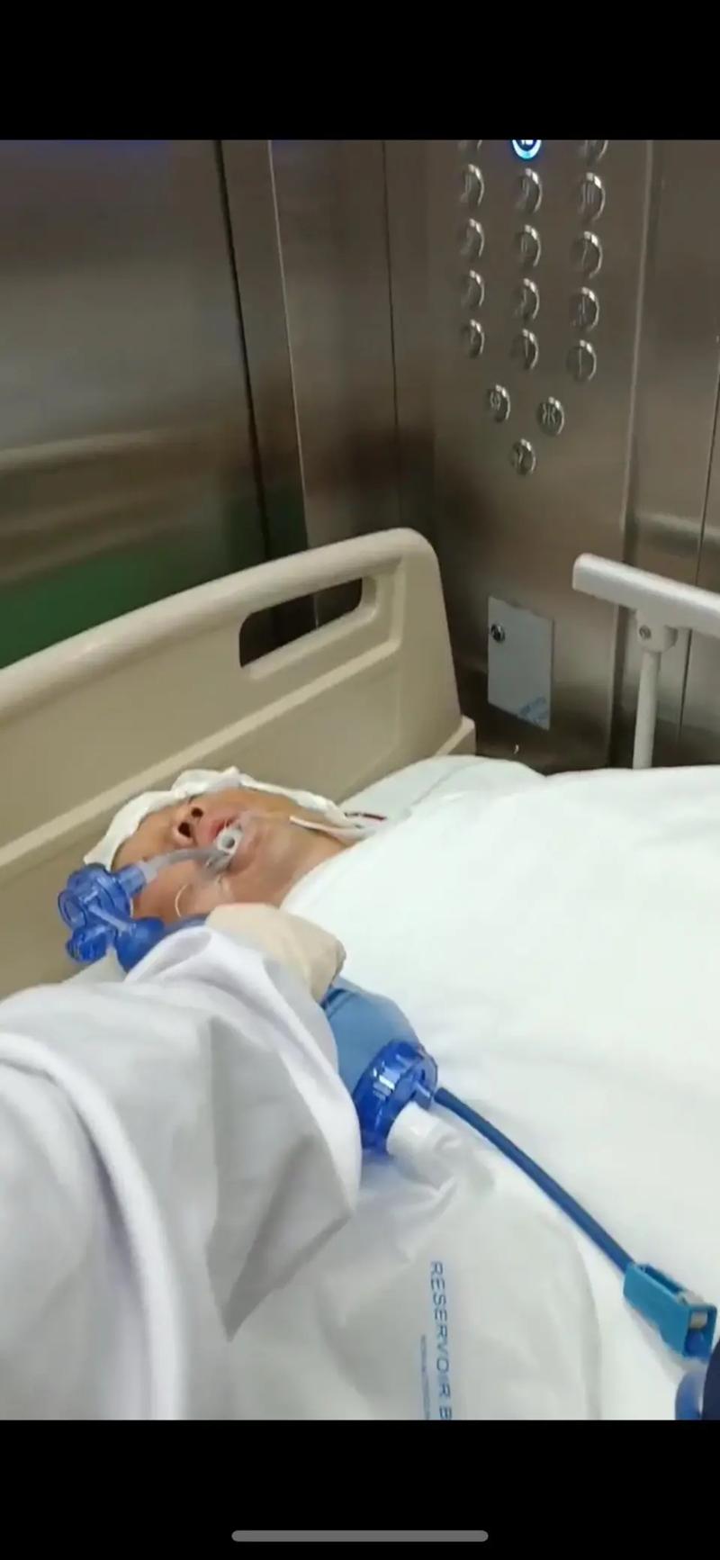 大面积脑梗引起脑水肿