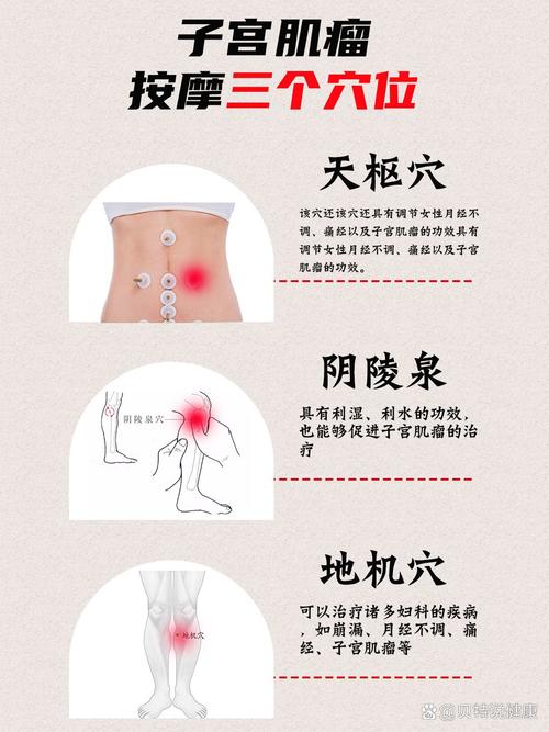 子宫肌瘤穴位按摩图