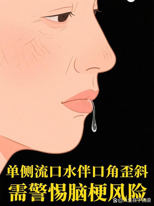 脑梗几年后突然流口水