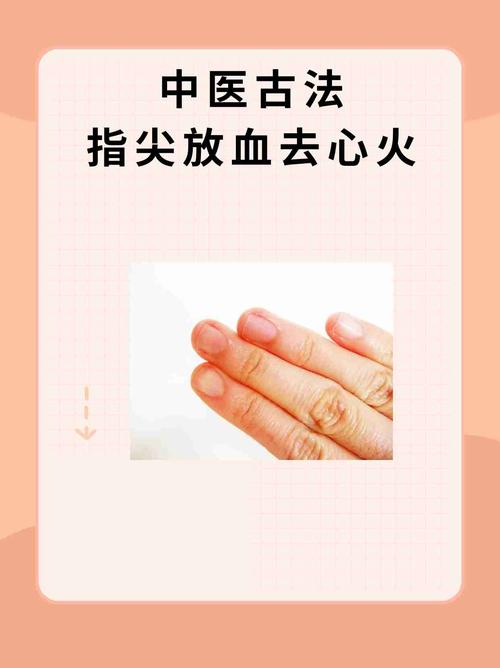 小手指末节穴位放血