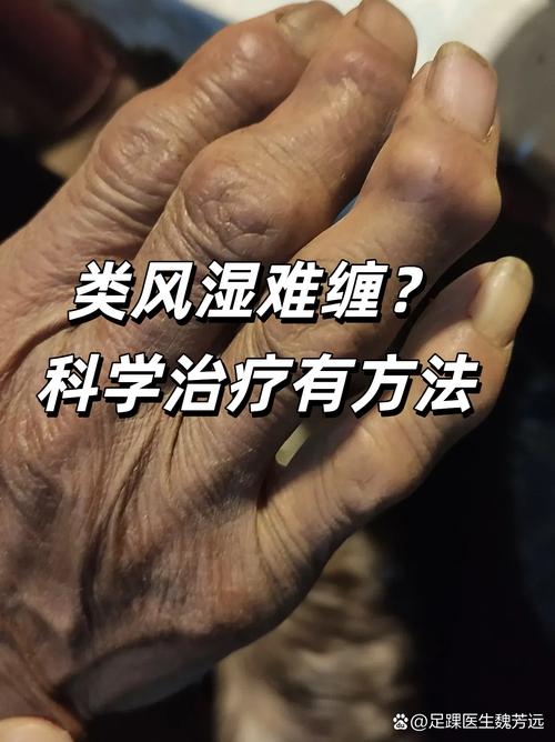 绝经后类风湿会加重吗