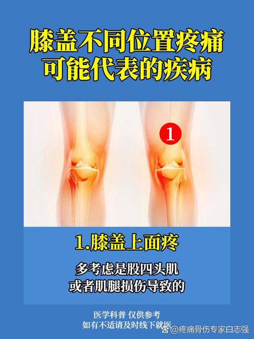 膝盖疼是风湿引起的吗