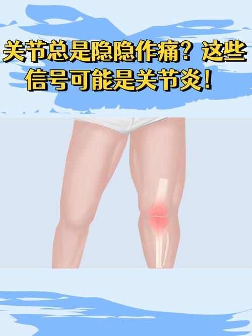 膝盖疼是风湿引起的吗