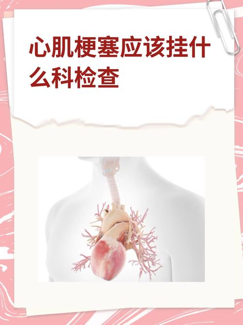 怀疑心梗脑梗挂什么科