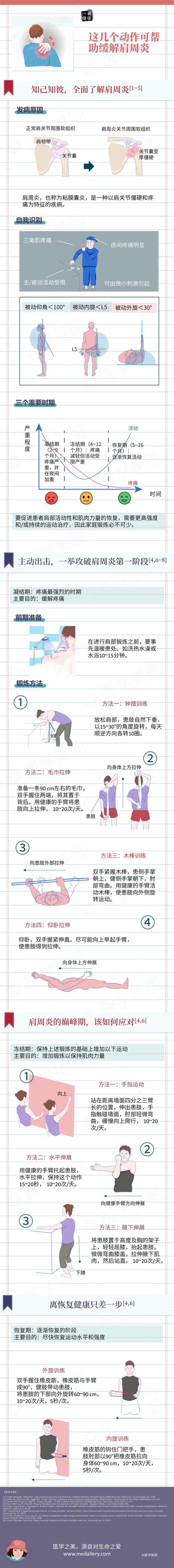 风湿性肩周炎 如何治