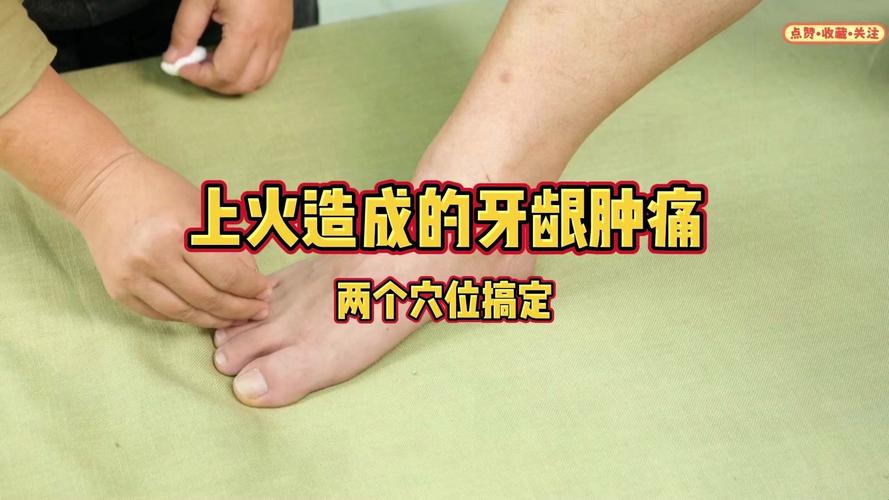 治疗牙龈出血的穴位