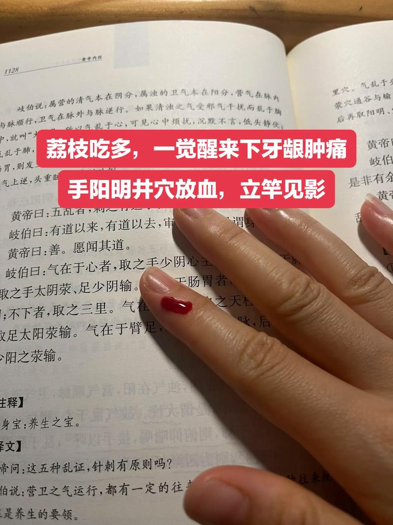 治疗牙龈出血的穴位