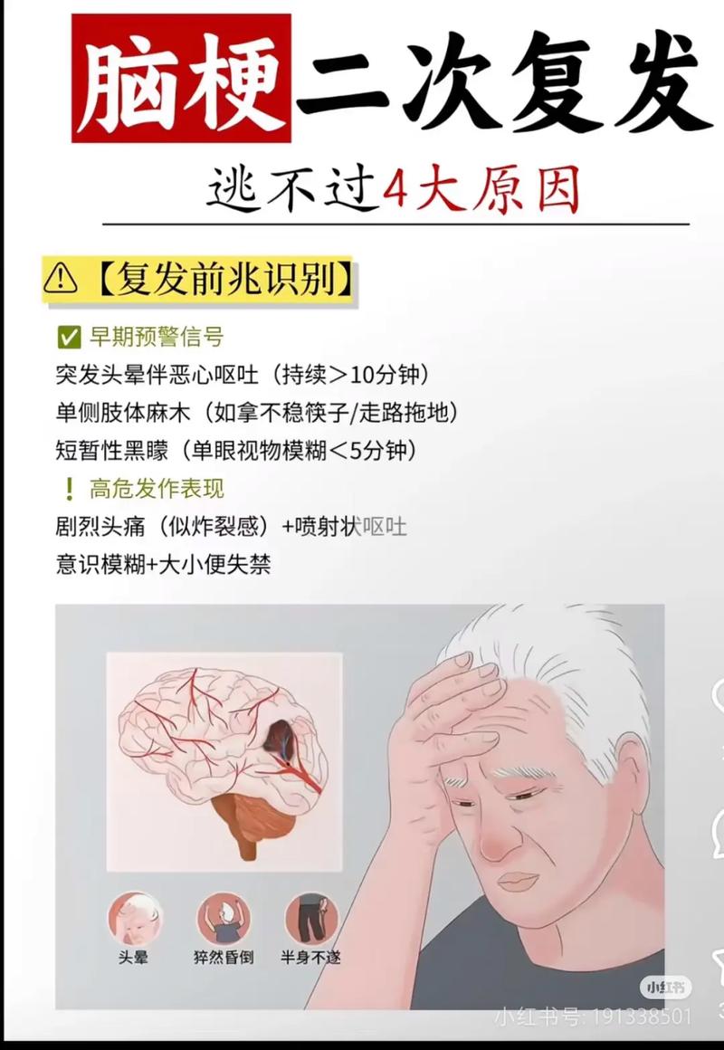 脑梗十年复发率有多高