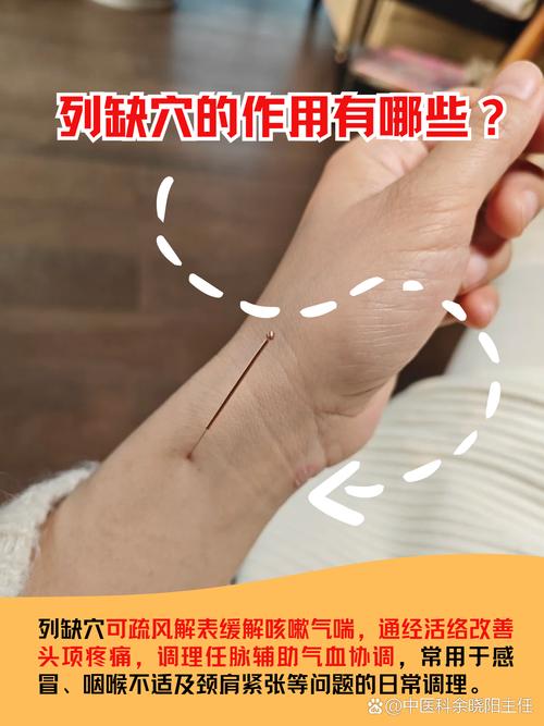 手腕部都有什么穴位