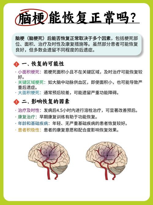 脑梗恢复几个月能开车
