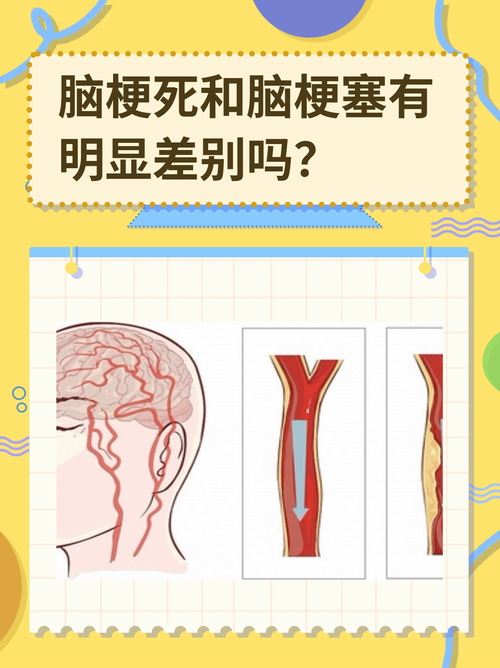 脑梗和血栓有什么区别
