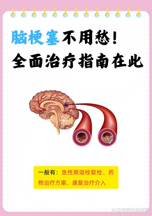 轻微脑梗能不能治好吗