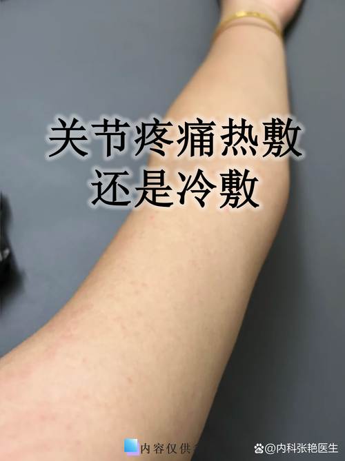 腿得了风湿可以热敷吗