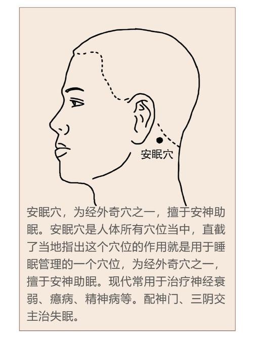 睡不着针灸哪些穴位