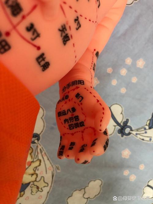 小孩发烧贴穴位治疗