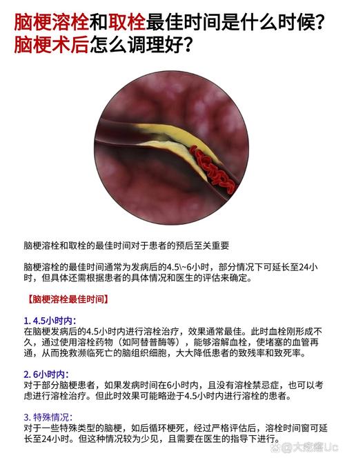 脑梗溶栓后多久能见效