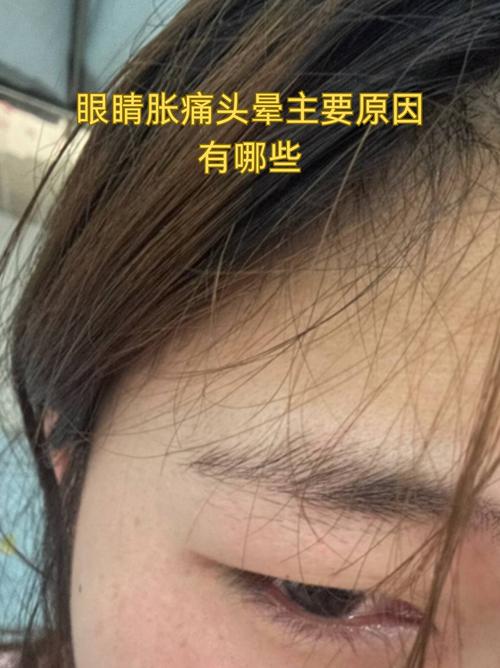 脑梗引起的眼睛看不见