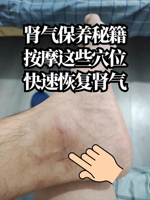 肾衰按摩什么穴位好