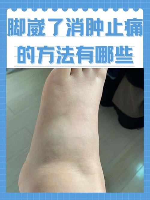 脑梗患者脚肿怎么消肿