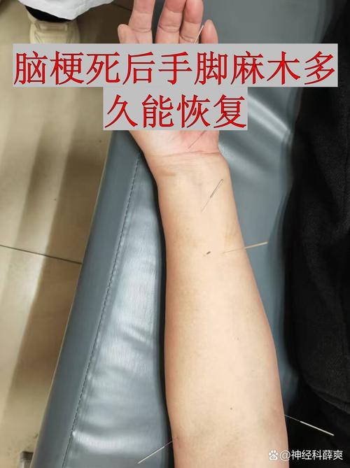 脑梗手脚麻木怎么按摩