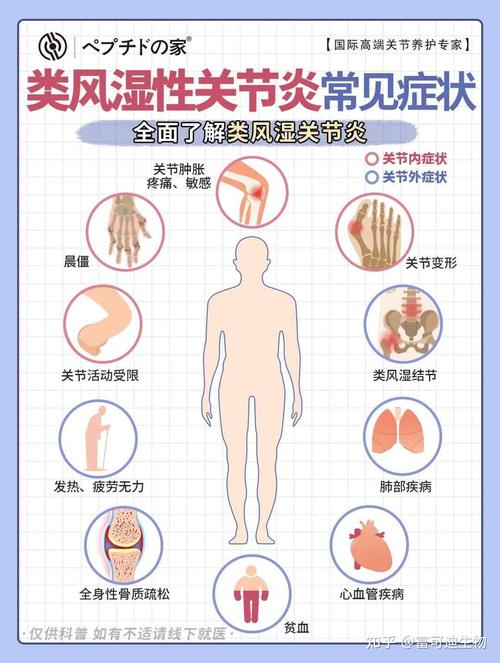 风湿免疫科疾病有哪些