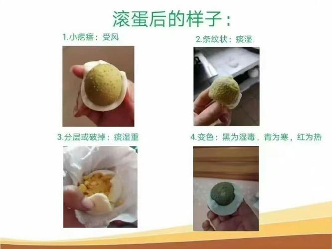 银子与鸡蛋怎么去风湿