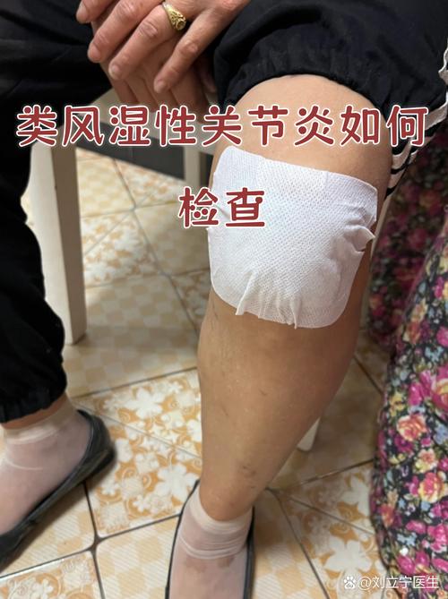 去医院怎么检查类风湿